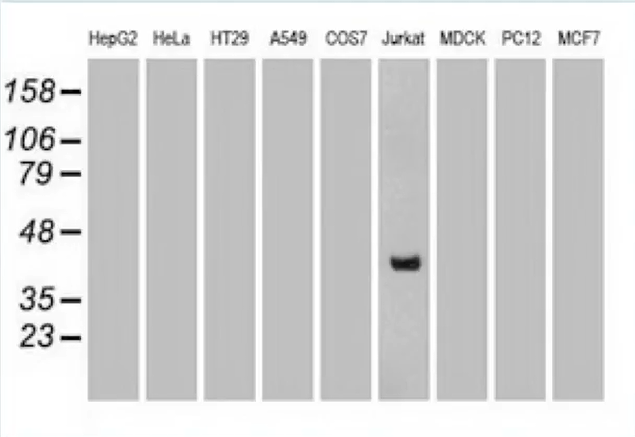 Western Blot Marker Chart
