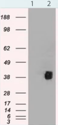 Western Blot Marker