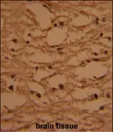 Brain Tissue