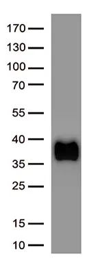 Western blot analysis of recombinant fusion protein of SARS-CoV-2 spike RBD protein and virion surface domain of membrane protein (Cat# TP701119, 0.05ug) by using anti-SARS-CoV-2 spike protein antibody