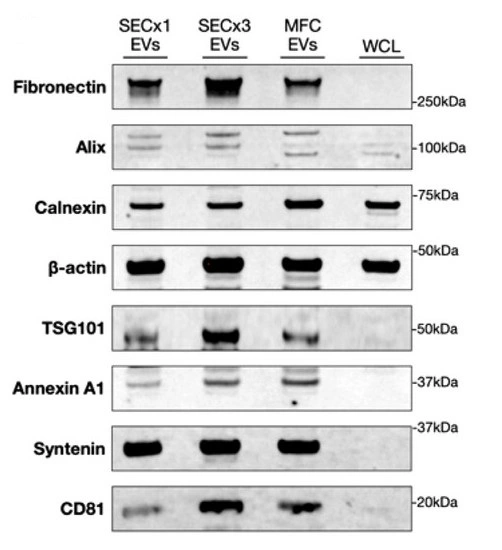 KRAS oncoprotein detected in EVs from SKBR-3 cells enriched by MagExo magnetic isolation
