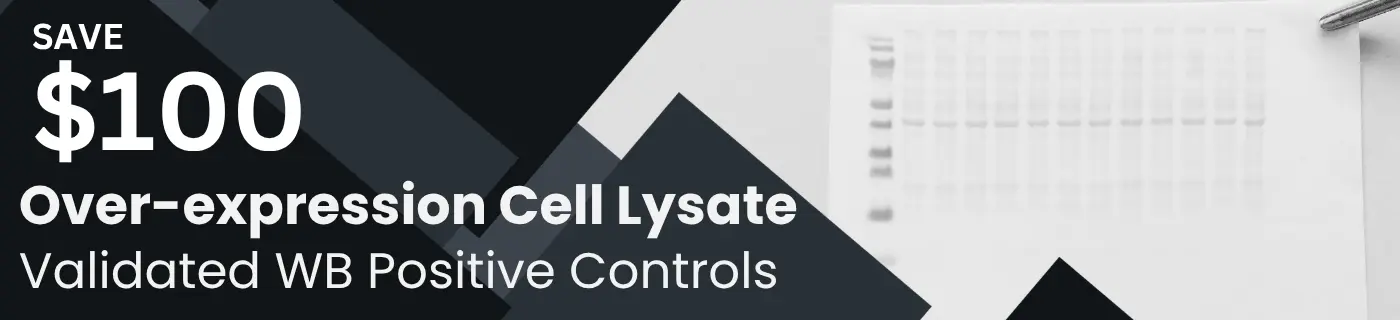 Promotion Banner