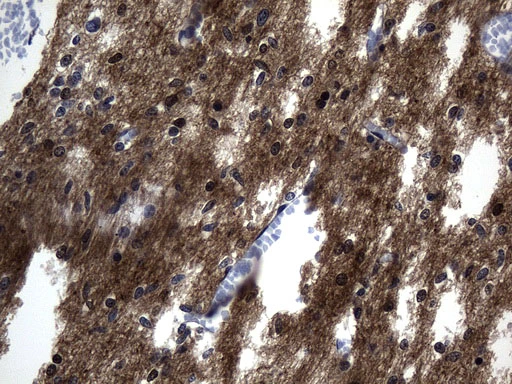IHC MAPT in human cerebellum with UM800131