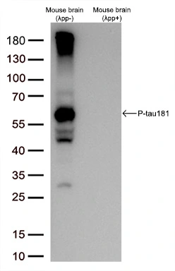 WB pT181 with and without phosphatase treatment