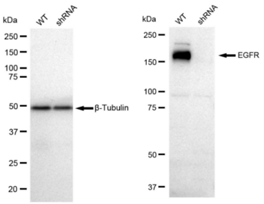 WB analysis of EGFR expression in WT and EGFR KD HeLa cell lysates using anti-EGFR antibody. β-Tubulin serves as a loading control.