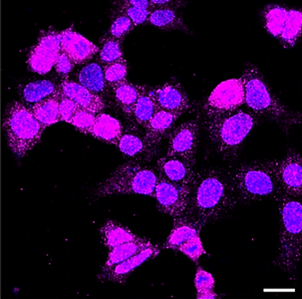 Immunocytochemical staining of HAP-1 cells with UCHL1 antibody. Nuclei: stained blue with DAPI; UCHL1: stained magenta with Alexa Fluor® 647