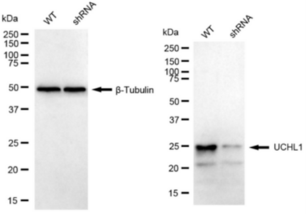 WB analysis of UCHL1 expression in WT and UCHL1 KD HAP1 cell lysates using anti-UCHL1 antibody. β-Tubulin serves as a loading control.