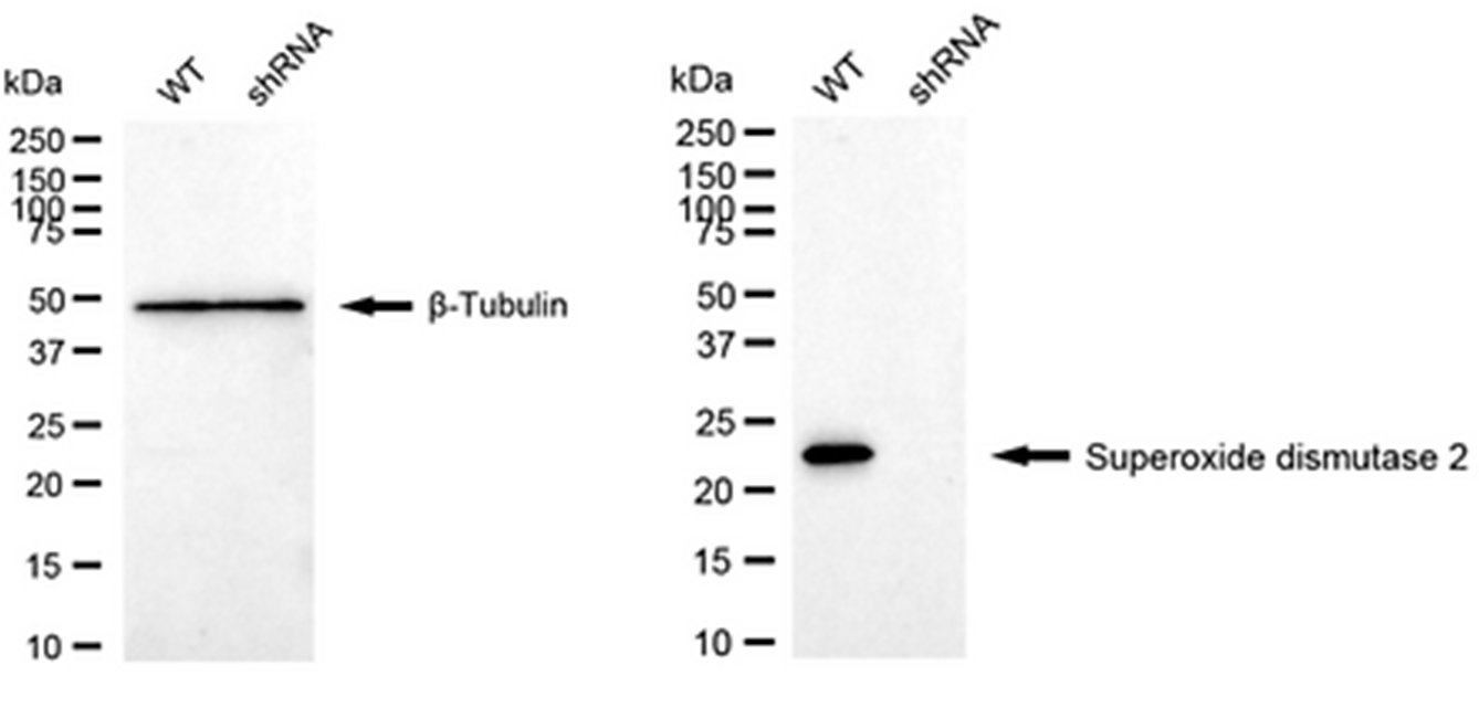 WB analysis of SOD2 expression in WT and SOD2 KD HeLa cell lysates using anti-SOD2 antibody. β-Tubulin serves as a loading control.