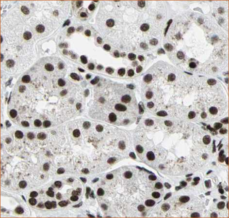 BRG1 antibody of kidney tissue. Image source: Protein atlas