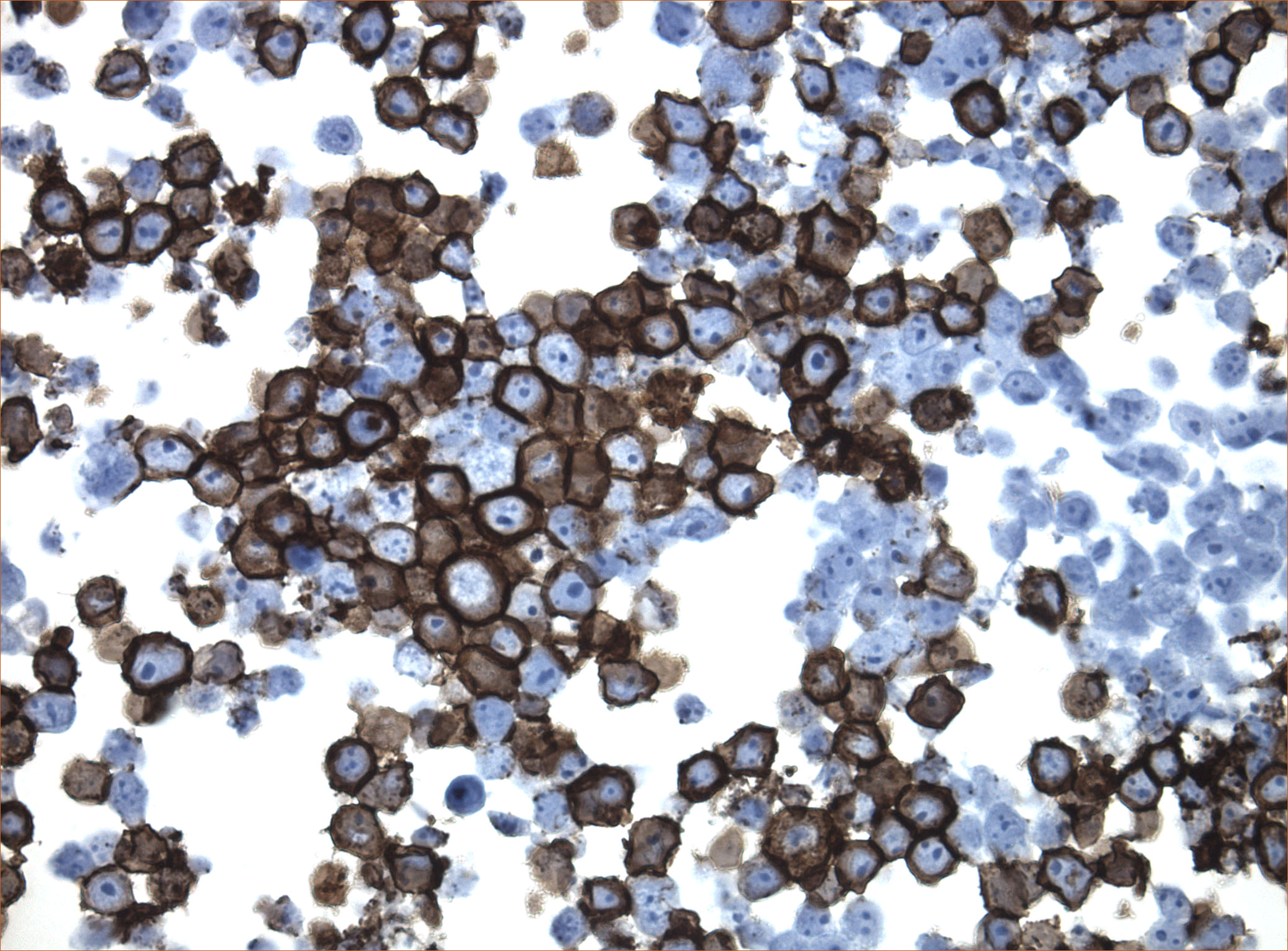 DDK-tag detection of DCC in CytoSection (TS418506P5)