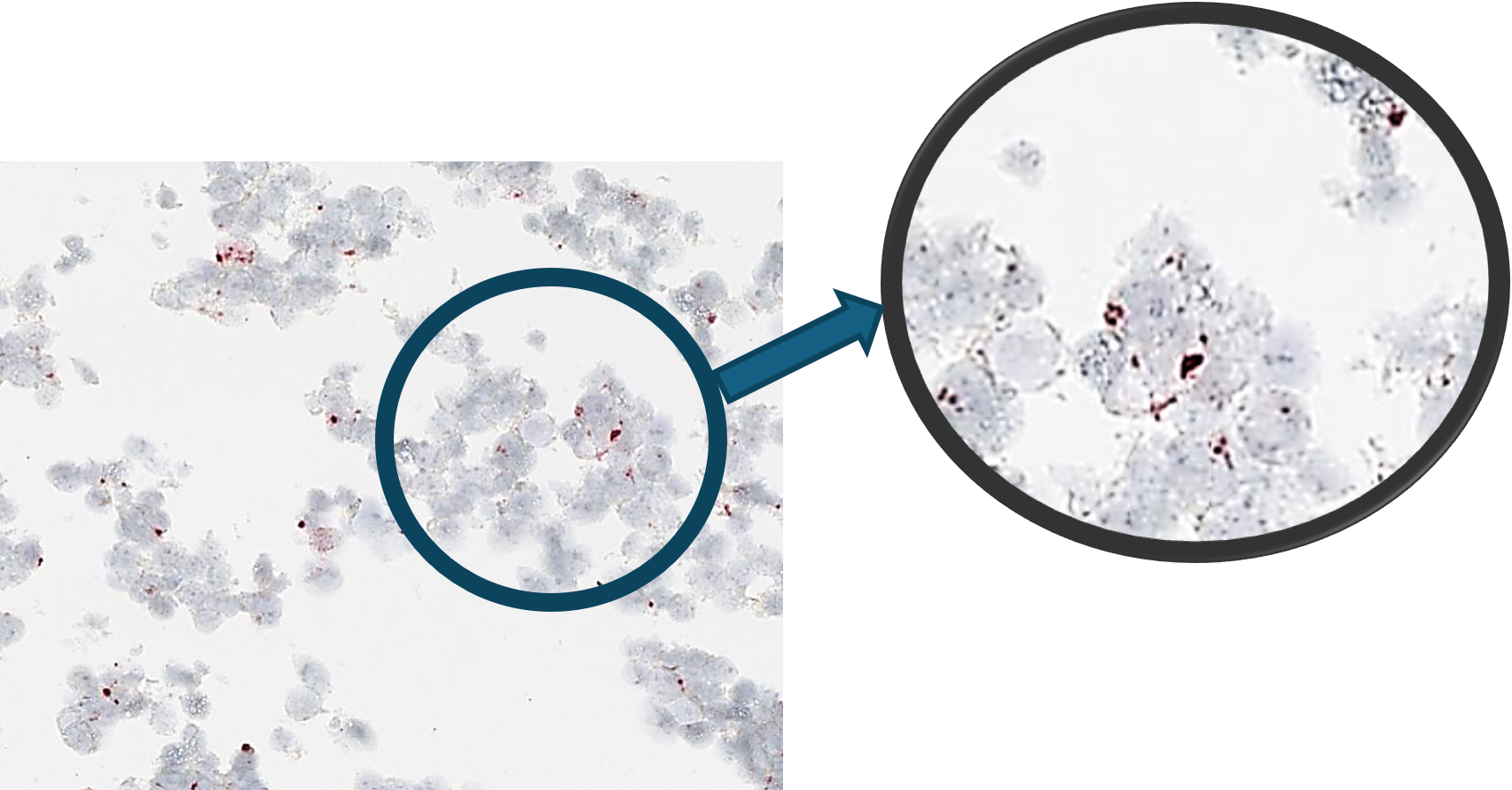 Positive Stained: ISH-based ENPP1 RNA probe
