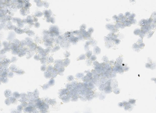 Negative Stained: ISH-based ENPP1 RNA probe