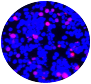 Overlay of DAPI, Anti-MAGEA3 Antibody