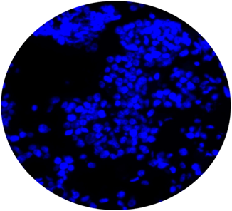 Overlay of DAPI, Anti-MAGEA3 Antibody