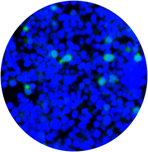 Overlay of DAPI, Anti-MAGEA3 Antibody