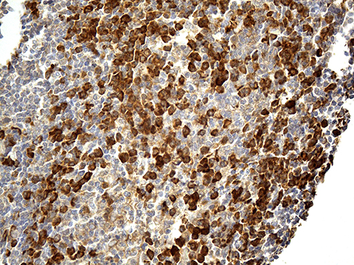 ta506383-cd163