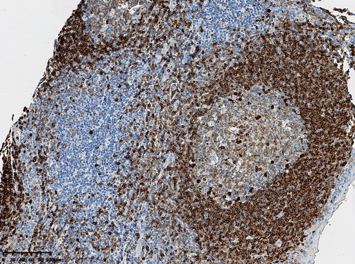 ta592833-cd79a