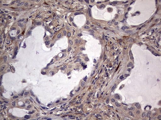 ta803784-fibronectin