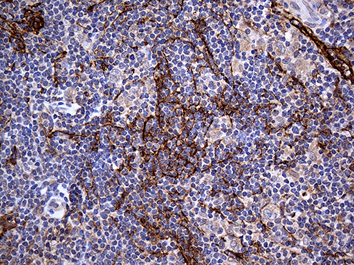 ta811684-pdpn