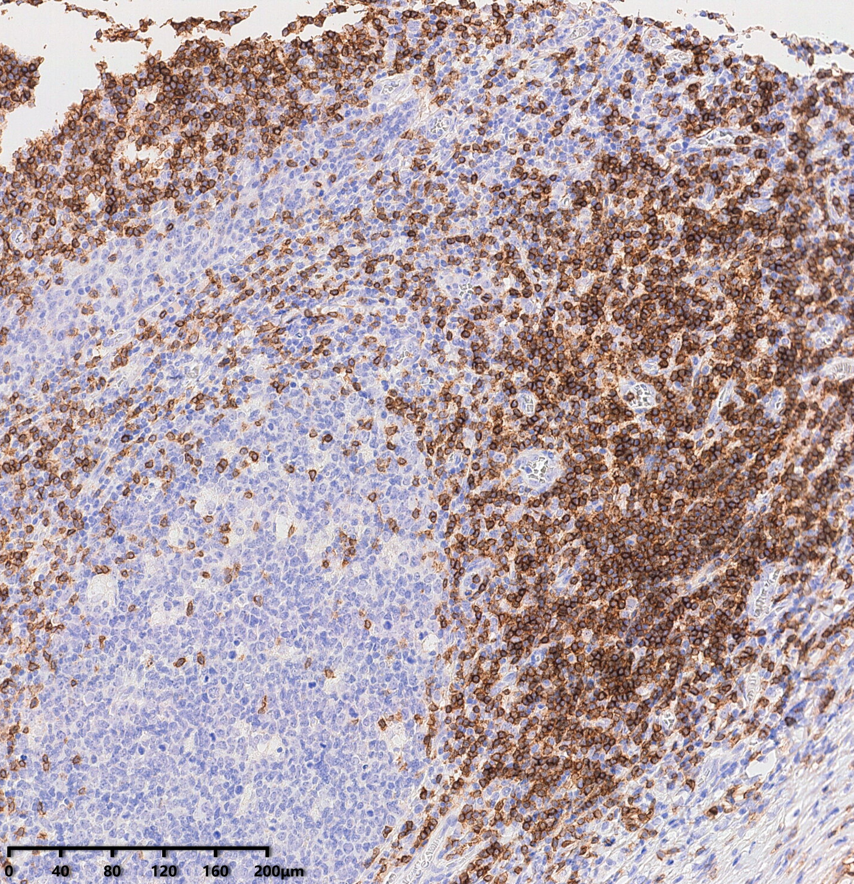 um500048-cd3e