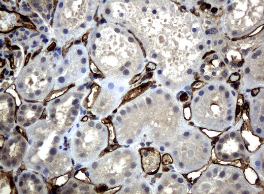 um500029-cd31