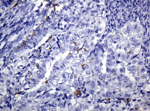 um500042-cd1c