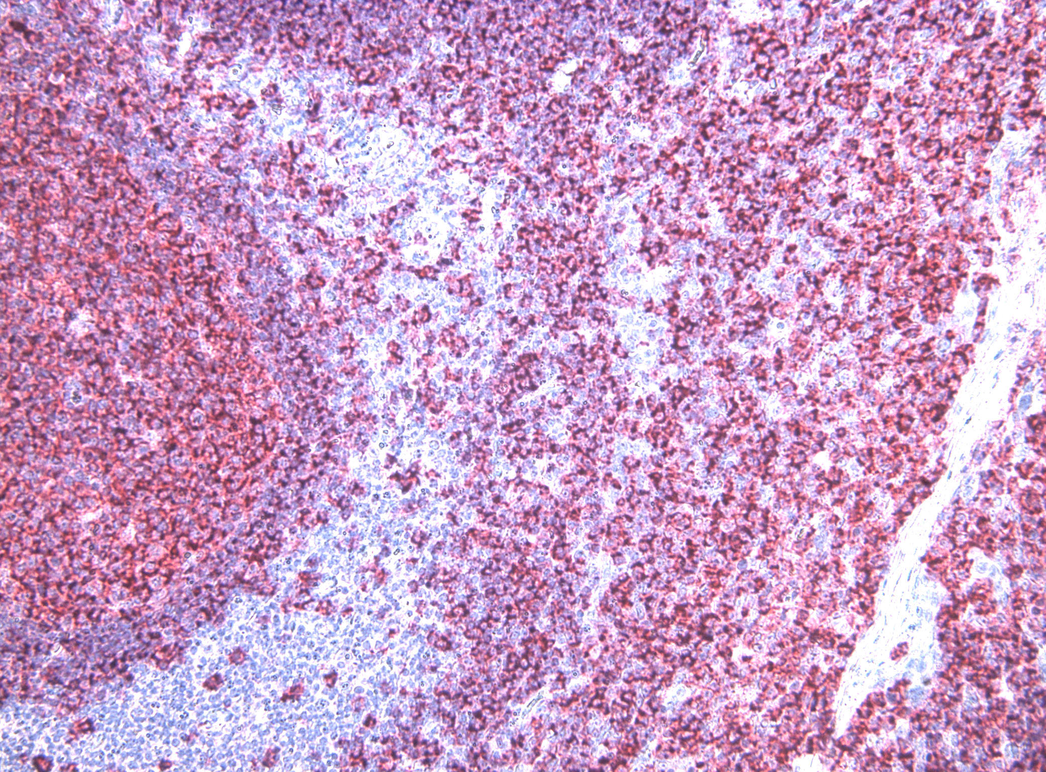 um800009-cd20