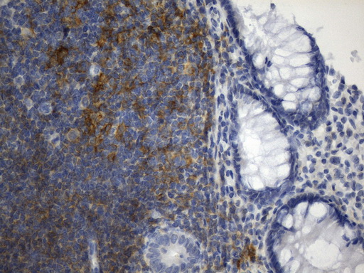 um800145-cd40