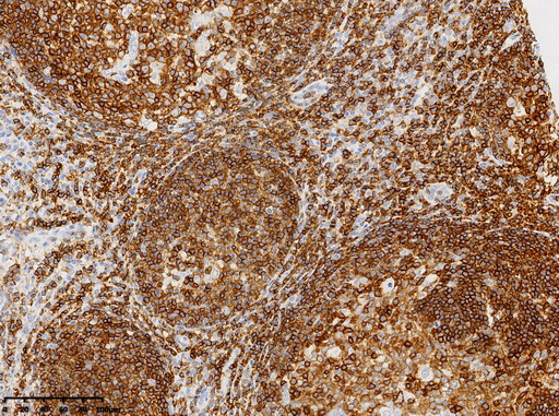 um800180-cd45