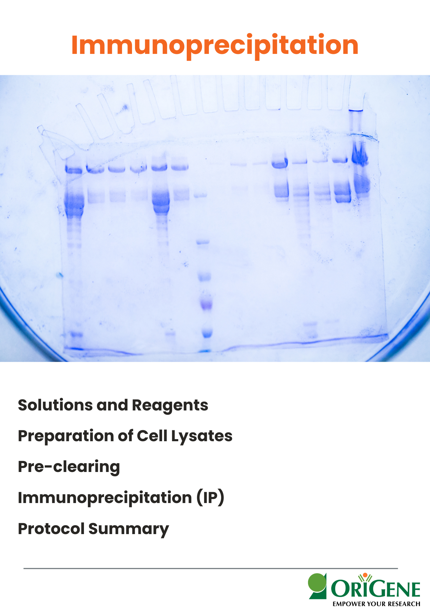 Immunoprecipitation