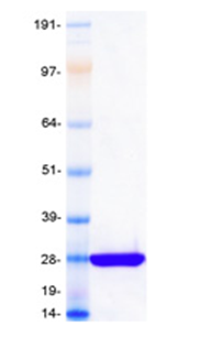 KRAS Mutant Myc-DDK Image