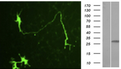 IF of the tGFP-fused protein in mouse E18 hippocampal pyramidal neurons Image