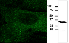 IF using anti-mCherry antibody in COS-7 cells transfected with mCherry-EEA1 Image