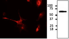 IF using anti-tdTomato antibody in HEK293 cells transfected with cDNA with tdtomato Image