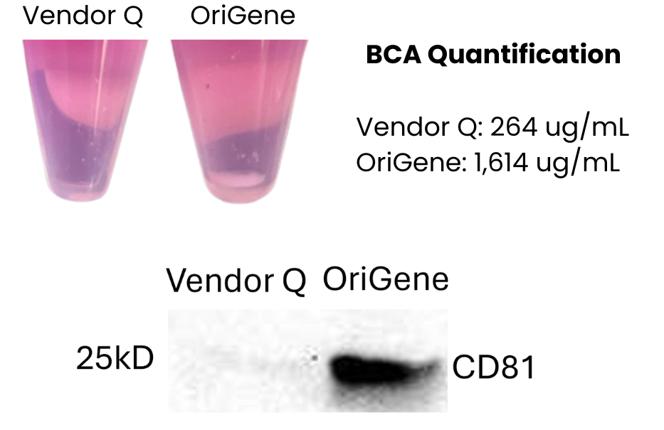 BCA and Western blot analysis