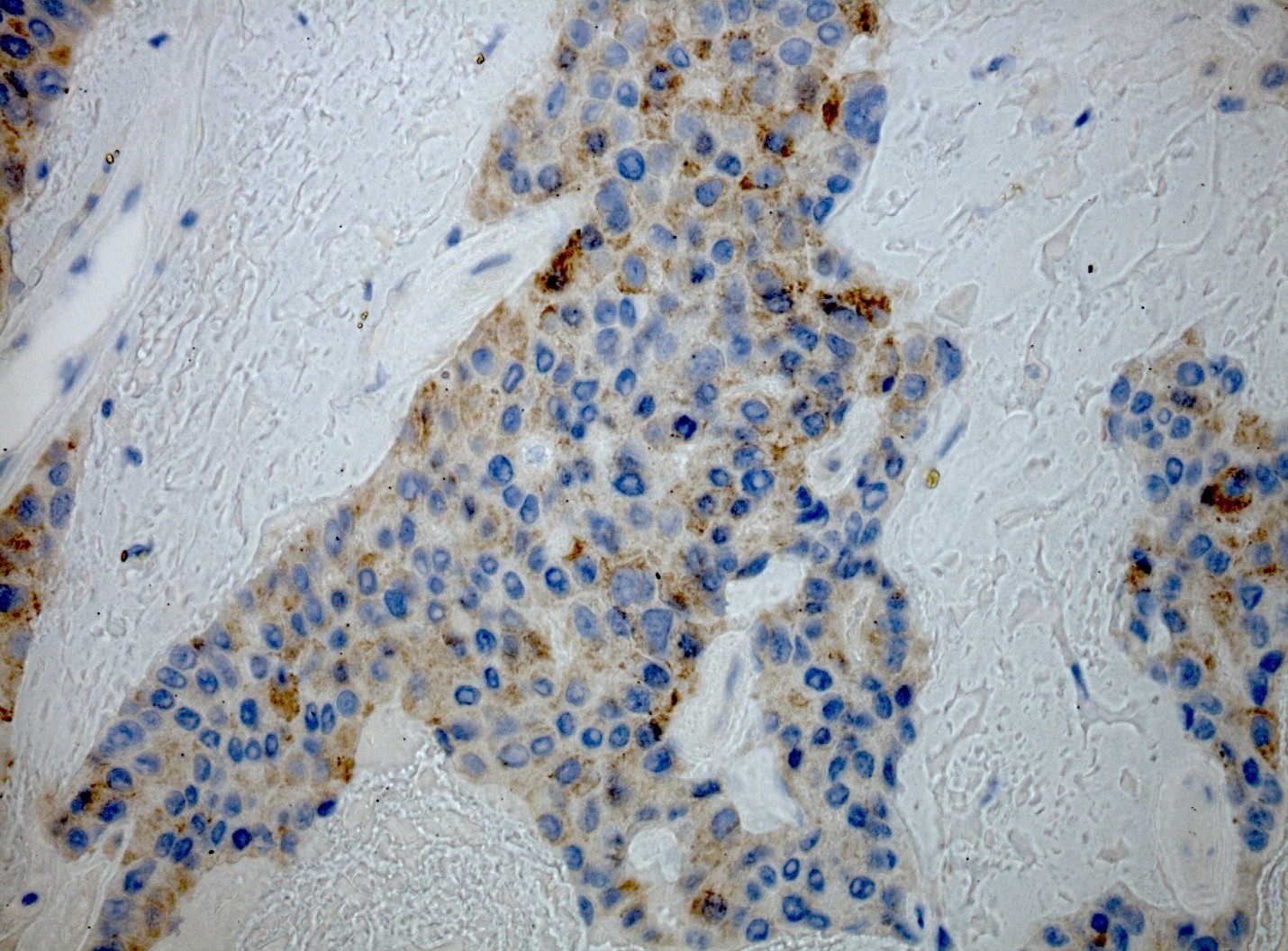 IHC Staining image