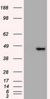 Western Blot: NAK Antibody (108A429) [TA336453] - Analysis of TBK1 using TBK1 antibody. Human Daudi (A) and mouse RAW (B) cell lysate probed with TBK1 antibody at 2 ug/ml.