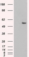 Western Blot: Caspase-3 (Pro and Active) Antibody (31A1067) [TA336455] - Lanes 1, 2 and 3 demonstrate the species crossreactivity of the antibody in human, mouse and rat heart lysate, respectively.