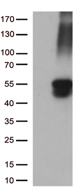 Western Blot: IKB alpha [p Ser32, p Ser36] Antibody (39A1413) [TA336464] - Jurkat cells were treated for 30 min with 100 ug/ml ALLN (N-Acetyl-Leu-Leu-Norleucinal) - a Calpain inhibitor and also proteasome inhibitor that prevents IkBa dephosphorylation) fo