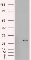 Western Blot: CD81 Antibody (1D6) [TA336485] - Western blot analysis of human testis tissue (A) using CD81 antibody at a concentration of 2 ug/ml.