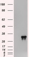 Western Blot: c-Myc Antibody (9E11) [TA336584] - Analysis of c-Myc in Jurkat whole cell lysate.