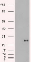 Western Blot: 68kDa Neurofilament Light Antibody (DA2) [TA336602] - Rat spinal cord homogenate showing the major intermediate filament proteins of the nervous system (lane 1). The remaining lanes show blots of this material stainted with various antibodie