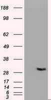 Western Blot: 58K Golgi Protein Antibody (58K-9) [TA336687] - Analysis of 58K golgi protein expression in rat liver tissue using TA336687.