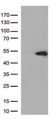 Western Blot: RICTOR Antibody (7B3) [TA336802] - Western blot analysis using RICTOR mouse mAb against Hela (1), PANC-1 (2), MOLT4 (3), HepG2 (4) and HEK293 (5) cell lysates.
