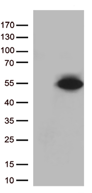 Western Blot: TLR5 Antibody (85B152.5) [TA336873] - Normal human bronchial epithelial total cell lysate. Image from verified customer review.