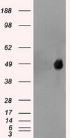 Western Blot: TLR5 Antibody (19D759.2) [TA337067] - BEAS-2B cells whole cell lysate. Image from verified customer review.