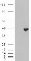 Western Blot: TLR3 Antibody (40C1285.6) [TA337075] - analysis of TLR3 in lysates from A) untransfected 293, B) 293 cells transfected with human TLR3 cDNA, C) human intestine, D) placenta, E) heart and F) ovary using TLR3 antibody at 3 ug/ml. Goat anti-mou
