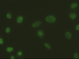 Western Blot: GAPDH Antibody (13H12) [TA337137] - analysis of GAPDH in HeLa and HEK 293 cells (25 ug/lane) using anti-GAPDH antibody. Image from verified customer review.
