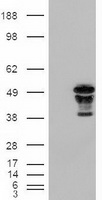 Western blot detection of HP1-gamma in Hela, 3T3, C6, COS7 and CHO-K1 cell lysates using HP1-gamma mouse mAb (1:1000 diluted).Predicted band size:22KDa.Observed band size:22KDa.