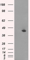 Western blot detection of E2F-1 in C6, Raw264.7 and Hela cell lysates using E2F-1 mouse mAb (1:500 diluted).Predicted band size:70KDa.Observed band size:70KDa.